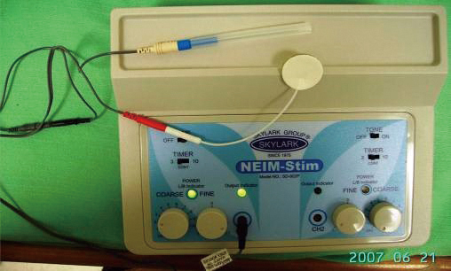針極肌肉內電刺激治療NEIMStim01